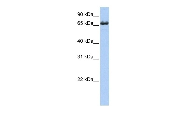ZDHHC17 Antibody