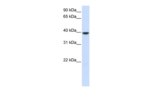 AGPAT5 Antibody