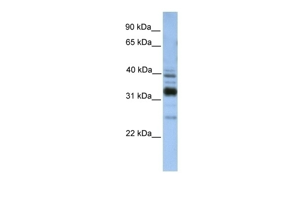 TXNDC13 Antibody