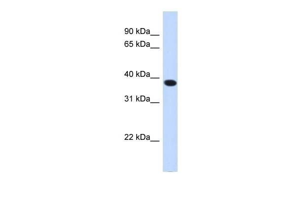 ACBD4 Antibody