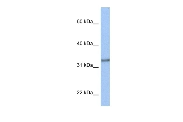 ACBD4 Antibody