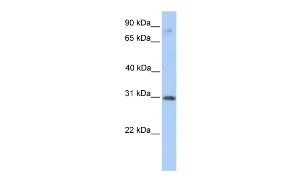 ABHD13 Antibody