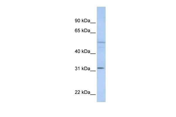 ZFYVE19 Antibody