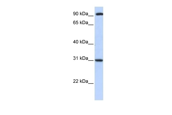 ANKRA2 Antibody