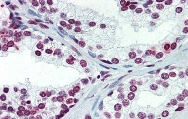 ARID5A Antibody