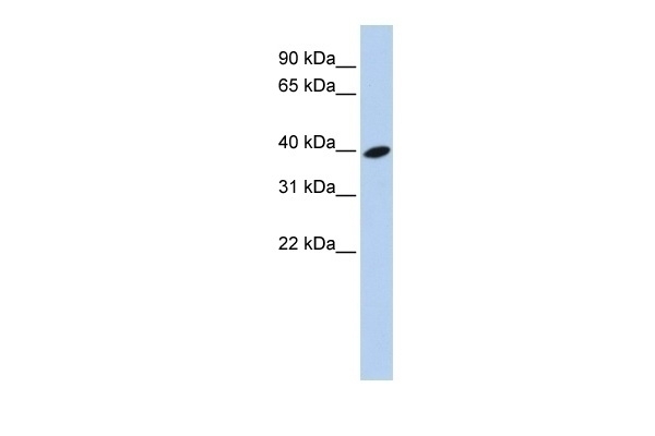 ARL13B Antibody