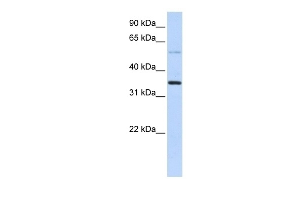 ANKRD9 Antibody