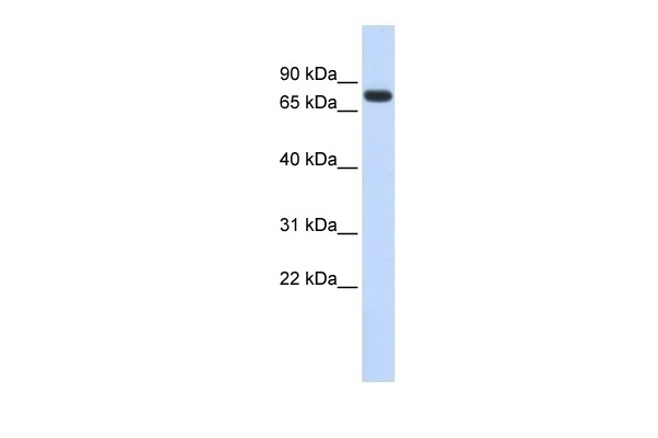 ANKRD13B Antibody