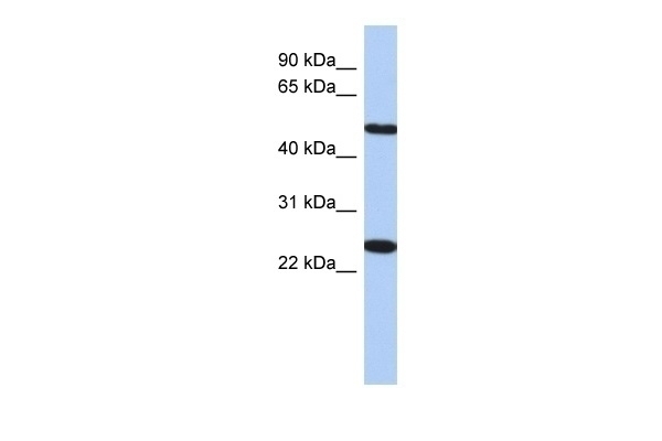 TMEM161B Antibody