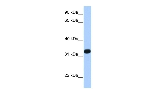 ACRV1 Antibody
