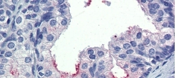 AMH Antibody