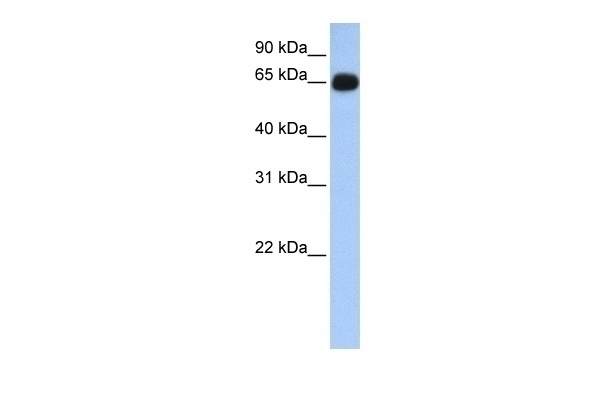ALAS1 Antibody