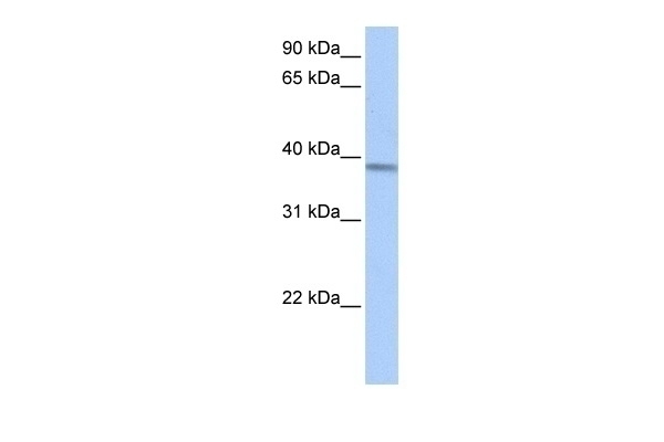 ACADSB Antibody