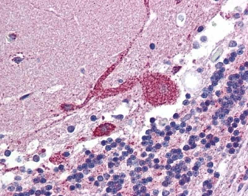 ARF6 Antibody