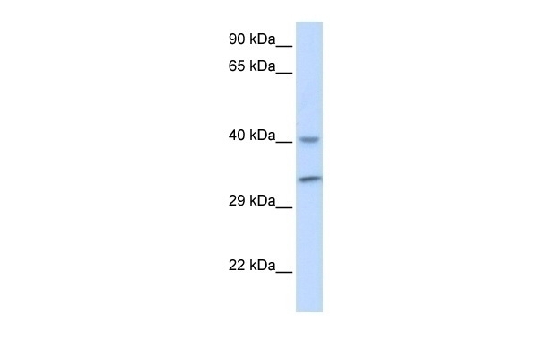 ALKBH3 Antibody