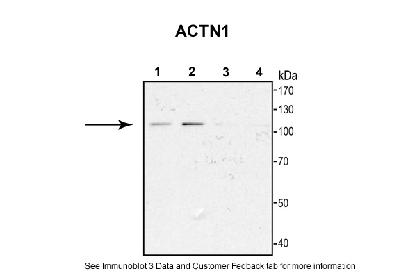 Actin alpha 1 Antibody