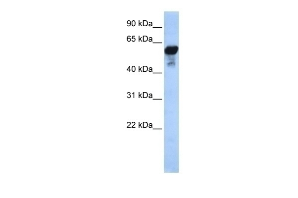 ALDH1B1 Antibody