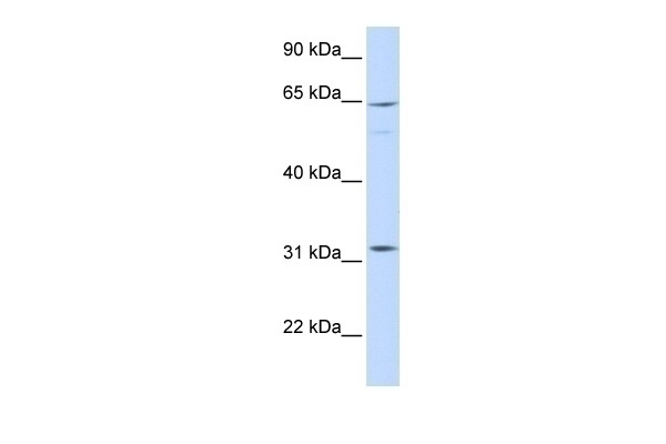 ARHGAP25 Antibody