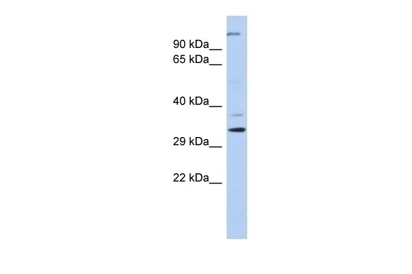ARPC2 Antibody