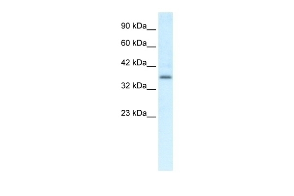 CMKLR1 Antibody