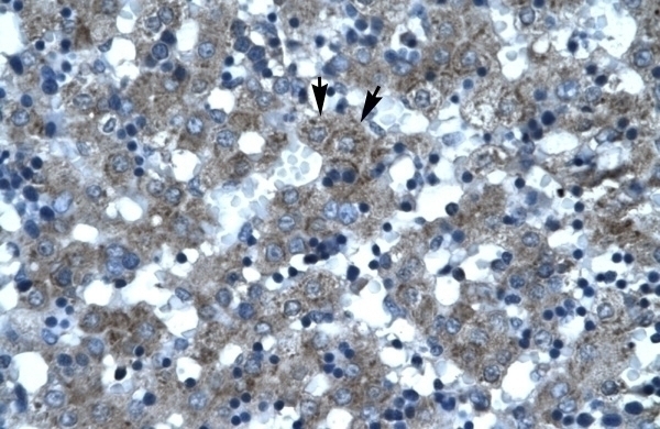 SUPT3H Antibody