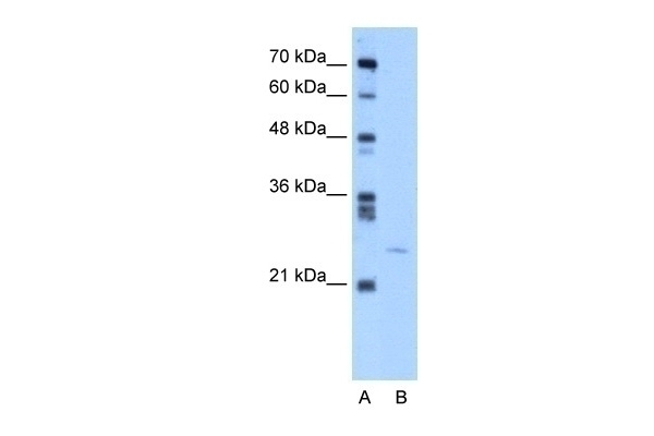 YEATS4 Antibody