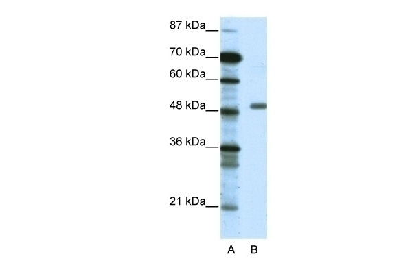 TADA3L Antibody