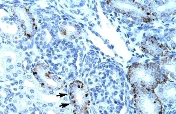 TCFL5 Antibody