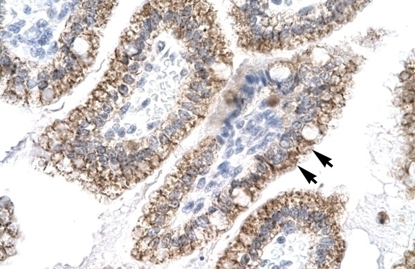 AEBP1 Antibody