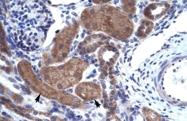 ZNFN1A2 Antibody