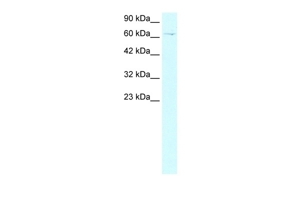 ZBTB20 Antibody