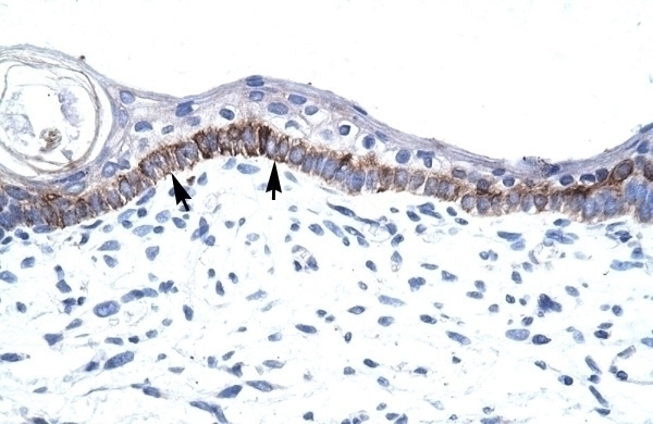 ARNTL Antibody
