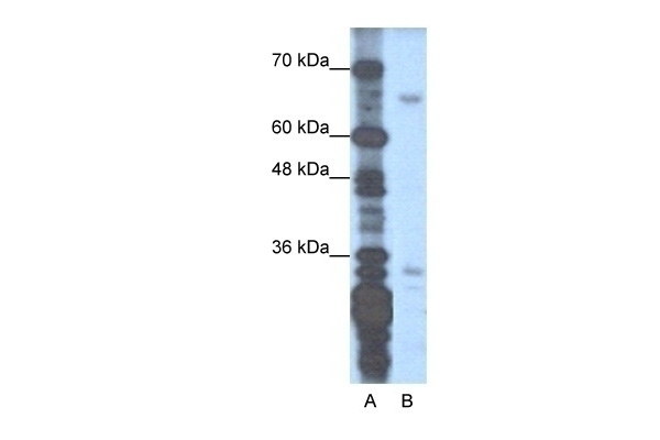 ZNF691 Antibody
