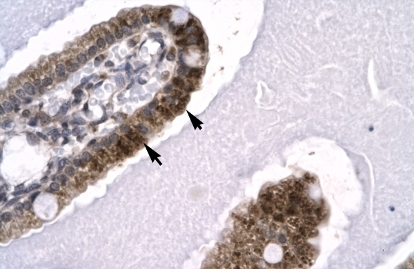 SKIIP Antibody