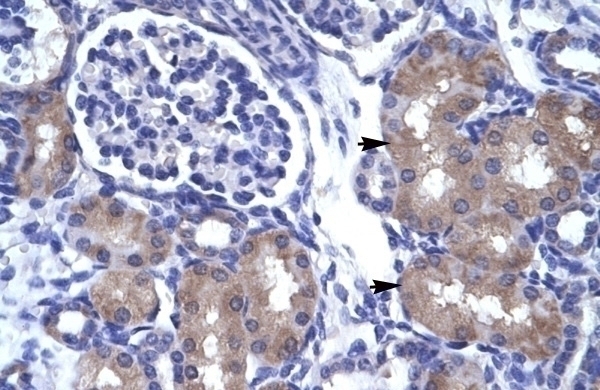 ASCL1 Antibody