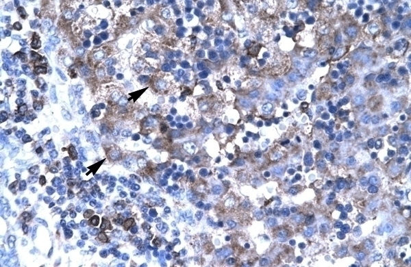 TBX19 Antibody