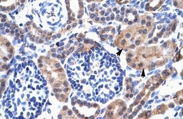 SIRT3 Antibody