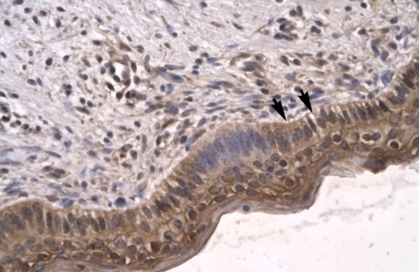 SIRT5 Antibody