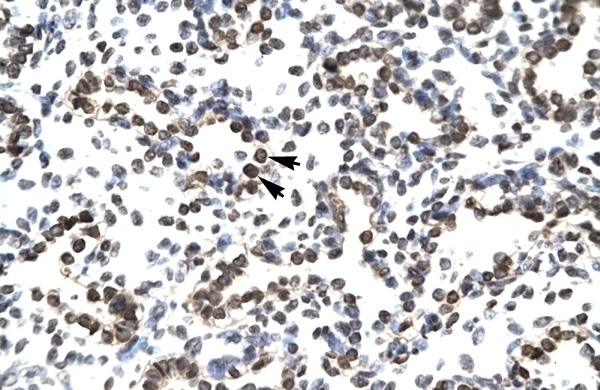 ZNF385 Antibody