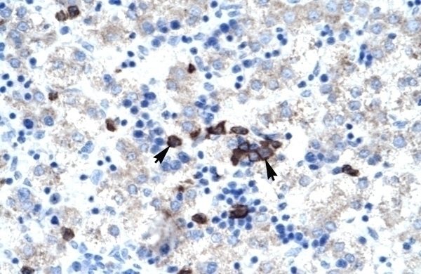 ABT1 Antibody