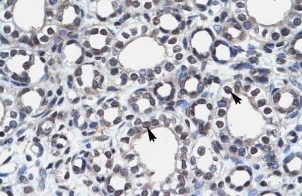 AIRE Antibody