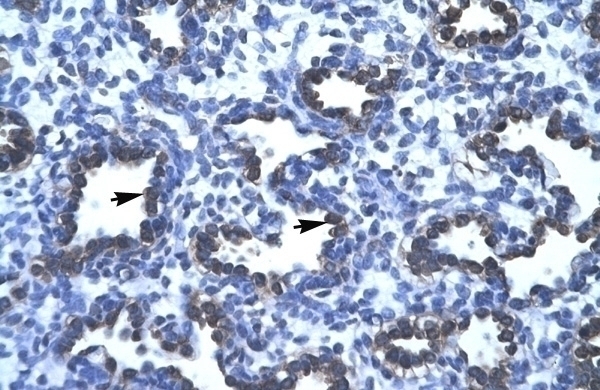 APEX1 Antibody