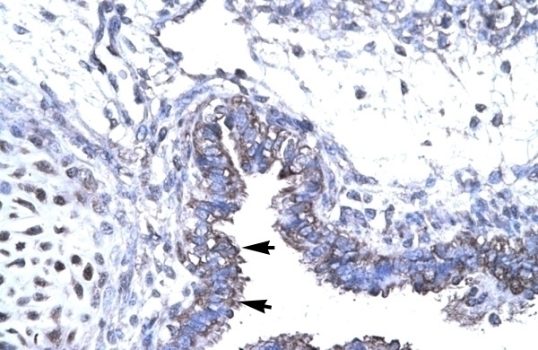 SMAD6 Antibody