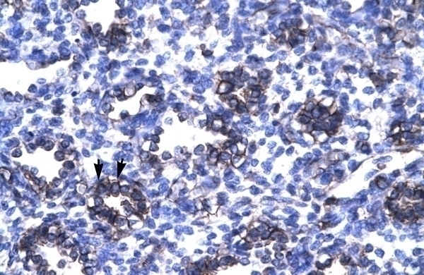 ZFP67 Antibody