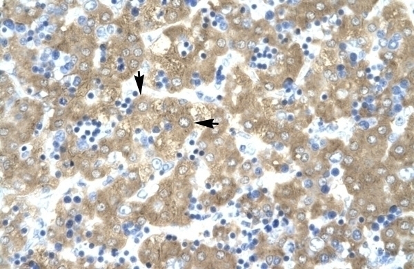 ACAT2 Antibody