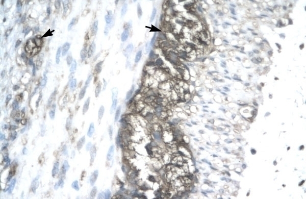 ACAT2 Antibody
