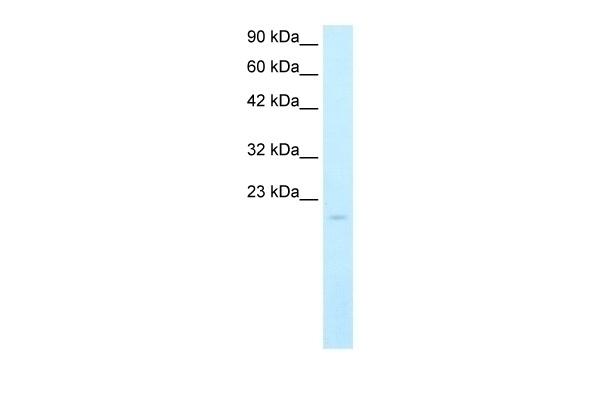 SP140 Antibody