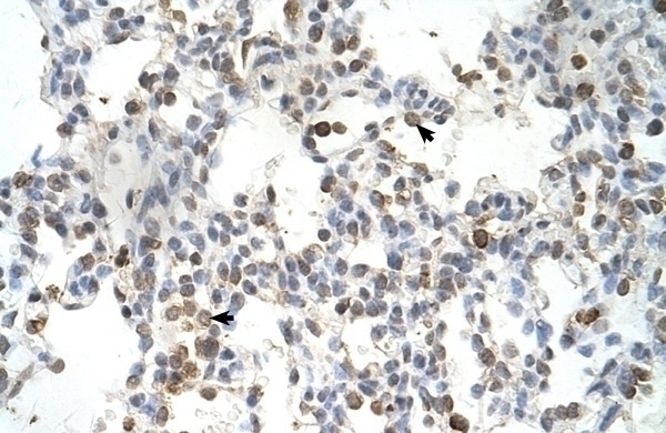 DLX5 Antibody