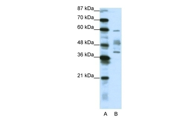 APTX Antibody