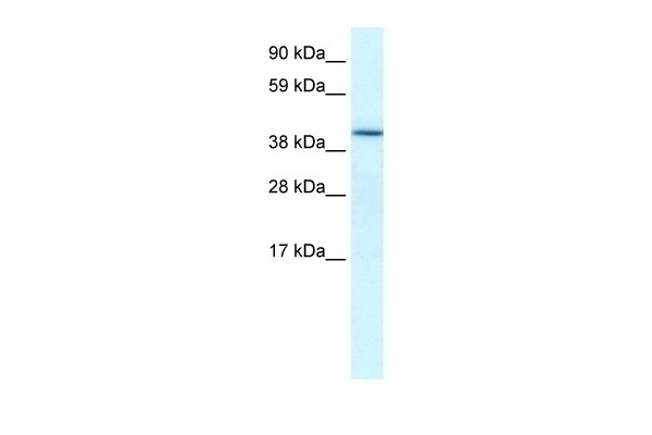 HIF1AN Antibody